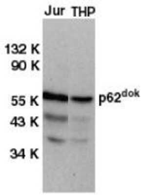 Western Blot: DOK1 AntibodyBSA Free [NBP1-77064]