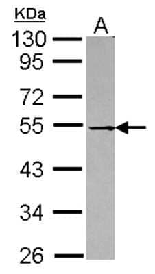 Western Blot: DOK1 Antibody [NBP2-16210]