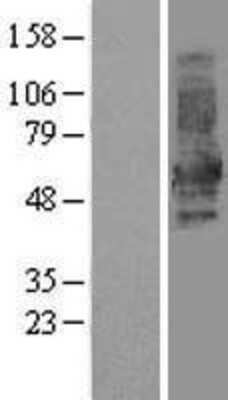 Western Blot: DOK1 Overexpression Lysate [NBL1-09977]