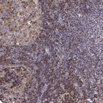 Immunohistochemistry-Paraffin: DOK2 Antibody [NBP2-62652]