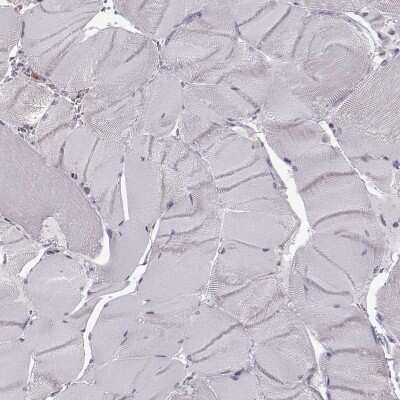 Immunohistochemistry-Paraffin: DOK2 Antibody [NBP2-62652]
