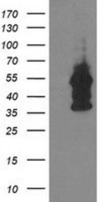 Western Blot: DOK2 Antibody (OTI1A4)Azide and BSA Free [NBP2-71407]