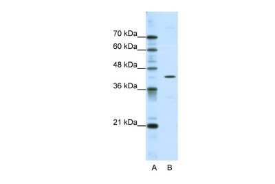 Western Blot: DOK2 Antibody [NBP2-84811]