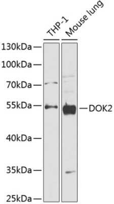 Western Blot: DOK2 AntibodyBSA Free [NBP2-92139]