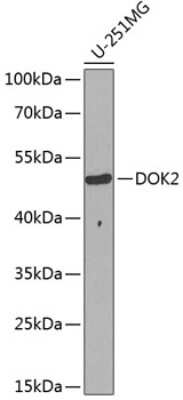 Western Blot: DOK2 AntibodyBSA Free [NBP2-92548]