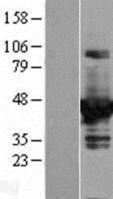 Western Blot: DOK2 Overexpression Lysate [NBL1-09978]