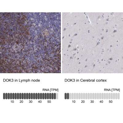 Immunohistochemistry-Paraffin: DOK3 Antibody [NBP2-62717]