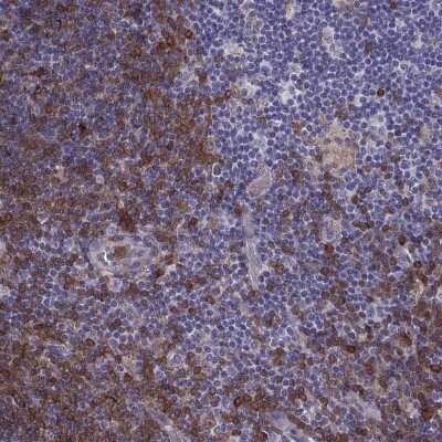 Immunohistochemistry-Paraffin: DOK3 Antibody [NBP2-62717]