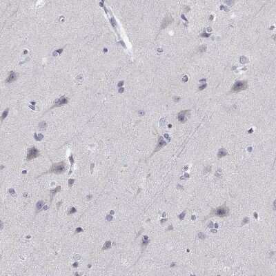 Immunohistochemistry-Paraffin: DOK3 Antibody [NBP2-62717]