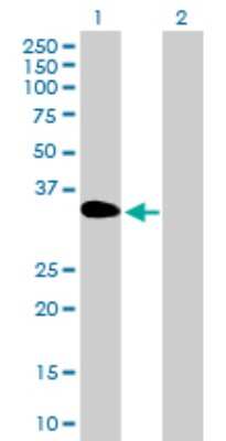 Western Blot: DOK3 Antibody [H00079930-B01P]