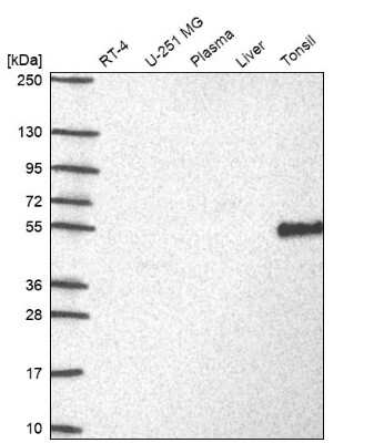 Western Blot: DOK3 Antibody [NBP2-62717]