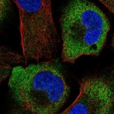 Immunocytochemistry/ Immunofluorescence: DOK4 Antibody [NBP3-17242]