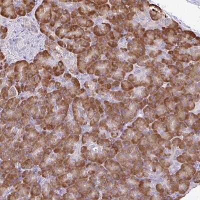 Immunohistochemistry-Paraffin: DOK4 Antibody [NBP2-33274]
