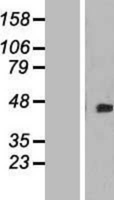 Western Blot: DOK4 Overexpression Lysate [NBL1-09979]