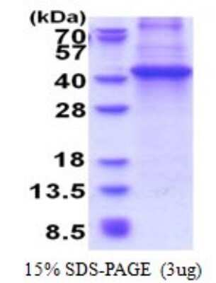 SDS-PAGE: Recombinant Human DOK4 His Protein [NBP2-51609]