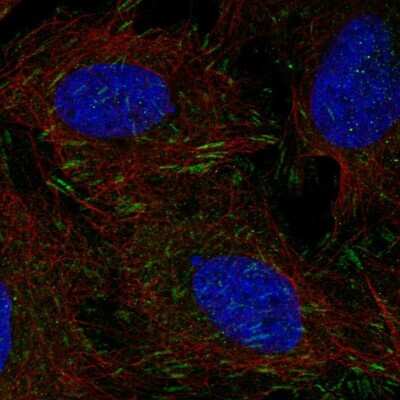 Immunocytochemistry/ Immunofluorescence: DOK5 Antibody [NBP2-58486]