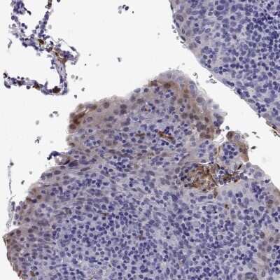 Immunohistochemistry: DOK5 Antibody [NBP2-39051]