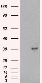 Western Blot: DOK5 Antibody [NB100-1463]