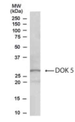 Western Blot: DOK5 Antibody [NB100-1463]