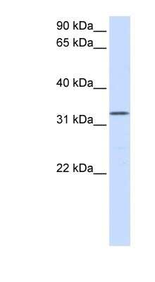 Western Blot: DOK5 Antibody [NBP1-56411]