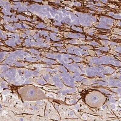 Immunohistochemistry: DOK6 Antibody [NBP2-32609]