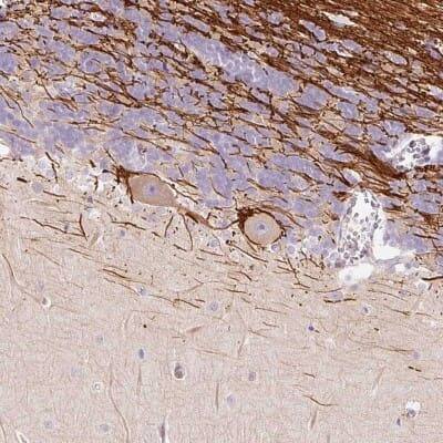 Immunohistochemistry: DOK6 Antibody [NBP2-32609]