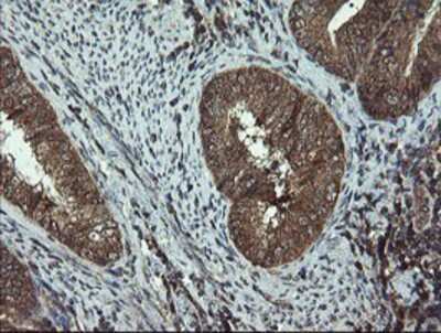 Immunohistochemistry-Paraffin: DOK7 Antibody (OTI1A9) [NBP2-02073]