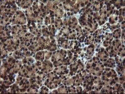 Immunohistochemistry-Paraffin: DOK7 Antibody (OTI1A9) [NBP2-02073]