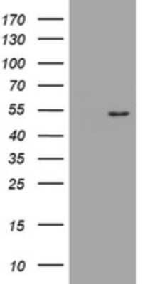 Western Blot: DOK7 Antibody (OTI2C12) [NBP2-46472]