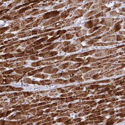 Immunohistochemistry-Paraffin: DOK7 Antibody [NBP2-32465]