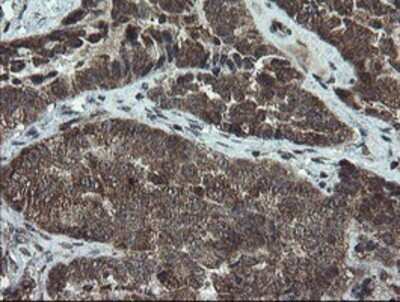 Immunohistochemistry: DOK7 Antibody (OTI1A9) - Azide and BSA Free [NBP2-72494]