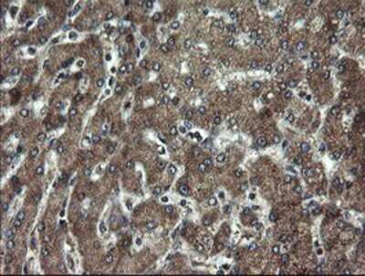 Immunohistochemistry: DOK7 Antibody (OTI1A9) - Azide and BSA Free [NBP2-72494]