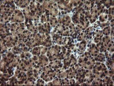 Immunohistochemistry: DOK7 Antibody (OTI1A9) - Azide and BSA Free [NBP2-72494]