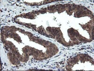 Immunohistochemistry: DOK7 Antibody (OTI1A9) - Azide and BSA Free [NBP2-72494]