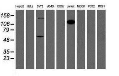 Western Blot: DOK7 Antibody (OTI1A9)Azide and BSA Free [NBP2-72494]