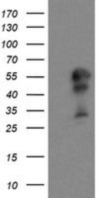 Western Blot: DOK7 Antibody (OTI1A9)Azide and BSA Free [NBP2-72494]