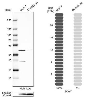 Western Blot: DOK7 Antibody [NBP2-32465]