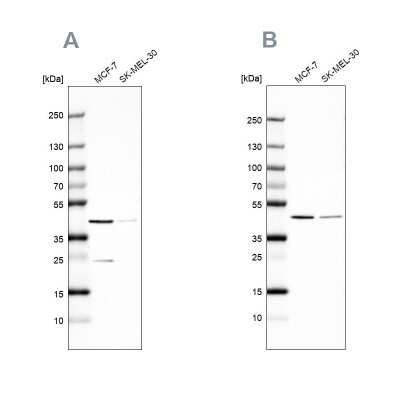 Western Blot: DOK7 Antibody [NBP2-32465]