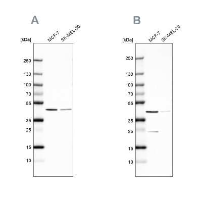 Western Blot: DOK7 Antibody [NBP2-68794]