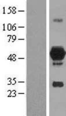 Western Blot: DOK7 Overexpression Lysate [NBP2-05129]