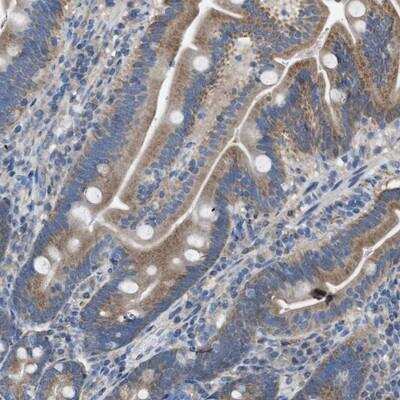 Immunohistochemistry-Paraffin: DOLPP1 Antibody [NBP1-81286]