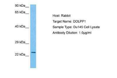 Western Blot: DOLPP1 Antibody [NBP2-84814]