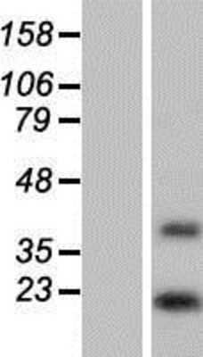 Western Blot: DOLPP1 Overexpression Lysate [NBP2-06652]