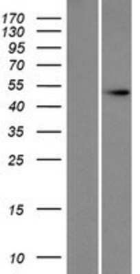 Western Blot: DXO Overexpression Lysate [NBP2-07740]