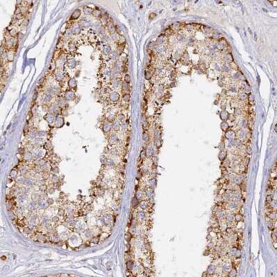 Immunohistochemistry-Paraffin: DONSON Antibody [NBP2-13931]