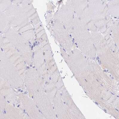 Immunohistochemistry-Paraffin: DONSON Antibody [NBP2-13931]