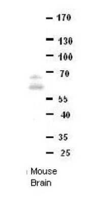 Western Blot: DONSON Antibody [NBP1-70752]