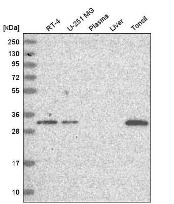 Western Blot: DONSON Antibody [NBP2-13931]