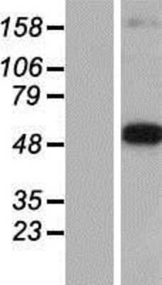 Western Blot: Dopa Decarboxylase/DDC Overexpression Lysate [NBL1-09766]