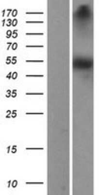 Western Blot: Dopa Decarboxylase/DDC Overexpression Lysate [NBP2-04178]